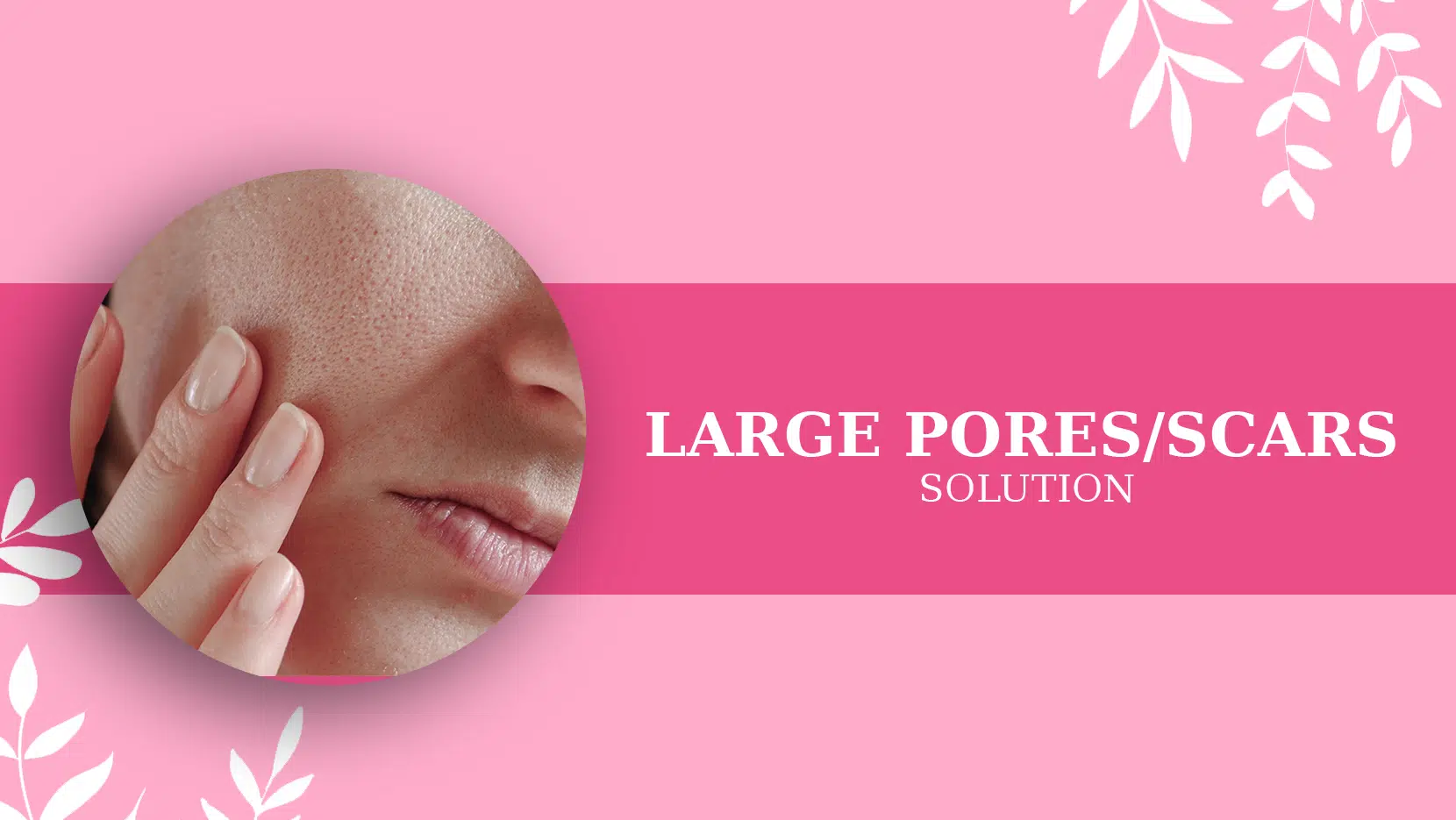 LARGE PORES SCARS SOLUTION