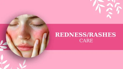 REDNESS RASHES